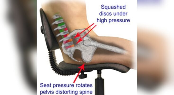 Can a Bad Chair Cause Back Pain